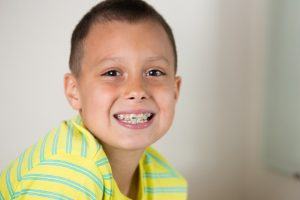 child with braces