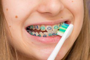 child brushing with braces