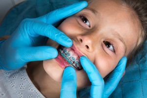 young child having braces adjusted 