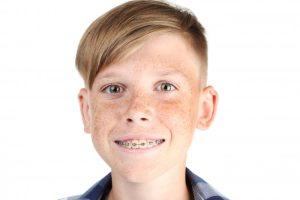 young boy with braces