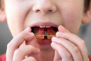 young boy with retainers in Powell 