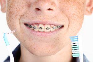 young boy with braces holding a flosser and toothbrush 