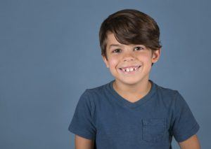 a young boy with buck teeth 