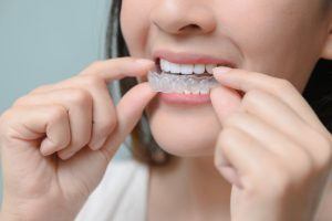 woman putting on an Invisalign tray 